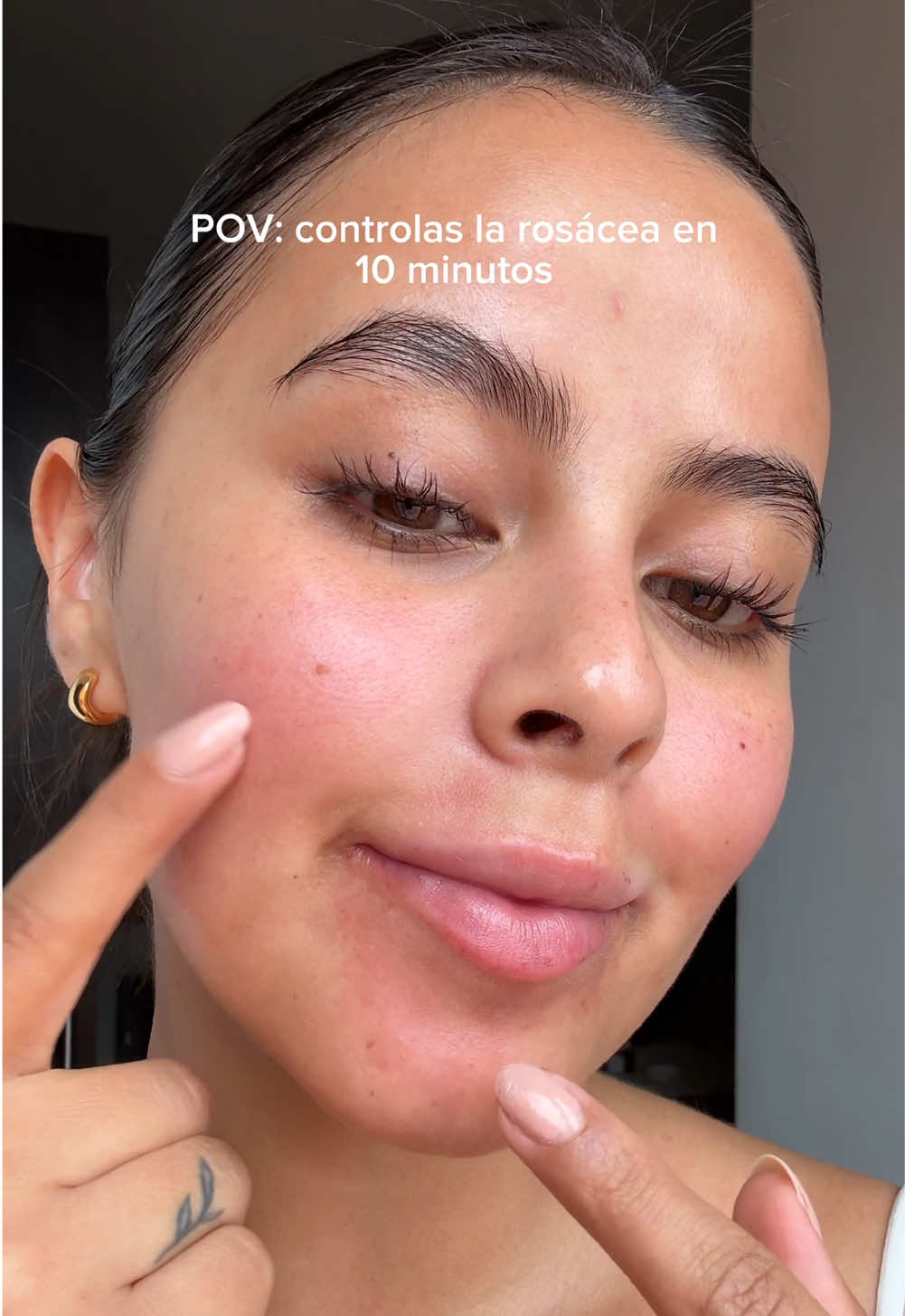 Para mejorar la rosácea en 10 minutos, este es el mejor invento de toda la vida Quick Calming Pad de @SKIN1004 Official #rosacea #calmingpad #kbeauty #centellaasiatica #pielsensible #koreanskincare #redness 
