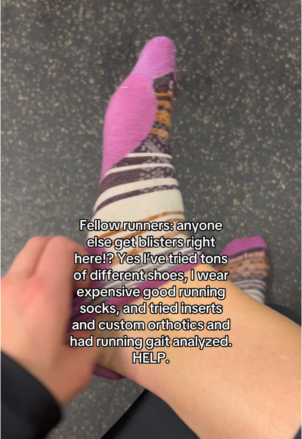 Do I just need to find a good blister pad/cream to cake on before every run or something!? #runningtips #run #blisters #runner 