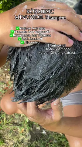 Minoxidil Hair Growth Shampoo #minoxidilhairgrowth #minoxidilhairgrowthshampo #dailyshampoorecommendation #hairlosstreatmenttips #minoxidil #minoxidilresult #hairgrowershampoo #shampooformen #hairgrowth #hairgrower #pampatubongbuhok #fyp #fypシ #fypage 