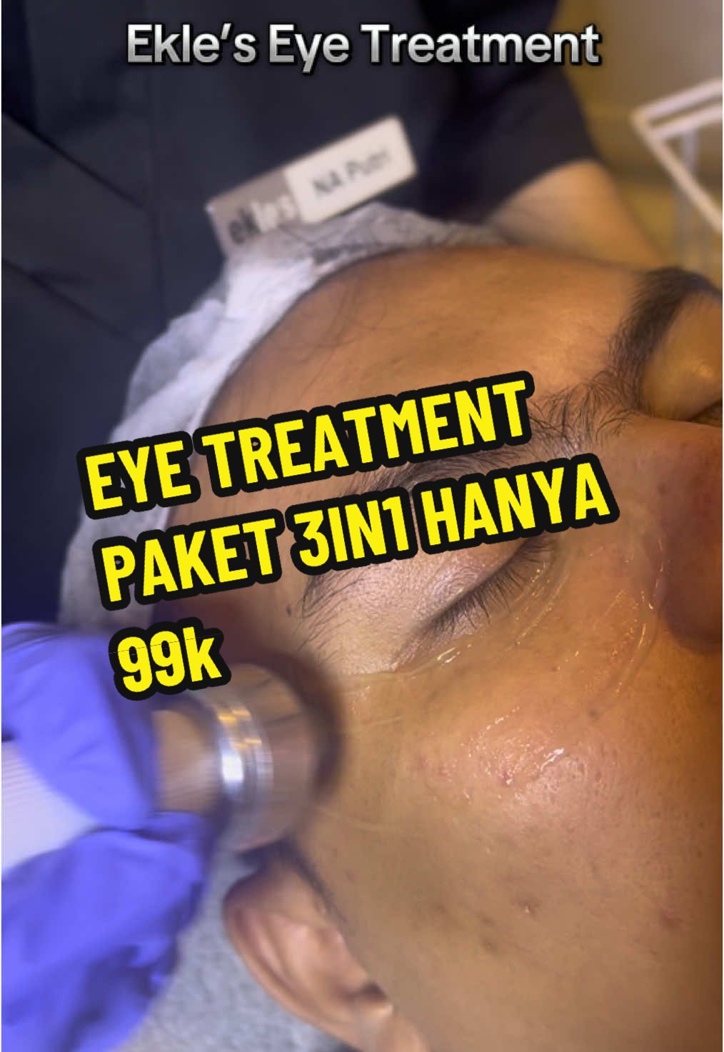 Eye treatment adalah perawatan untuk mata yang bertujuan mengurangi kerutan, lingkaran hitam, kantung mata, dan bayangan hitam di bawah mata. Perawatan ini dapat dilakukan dengan pijatan, serum, gel, atau laser. 