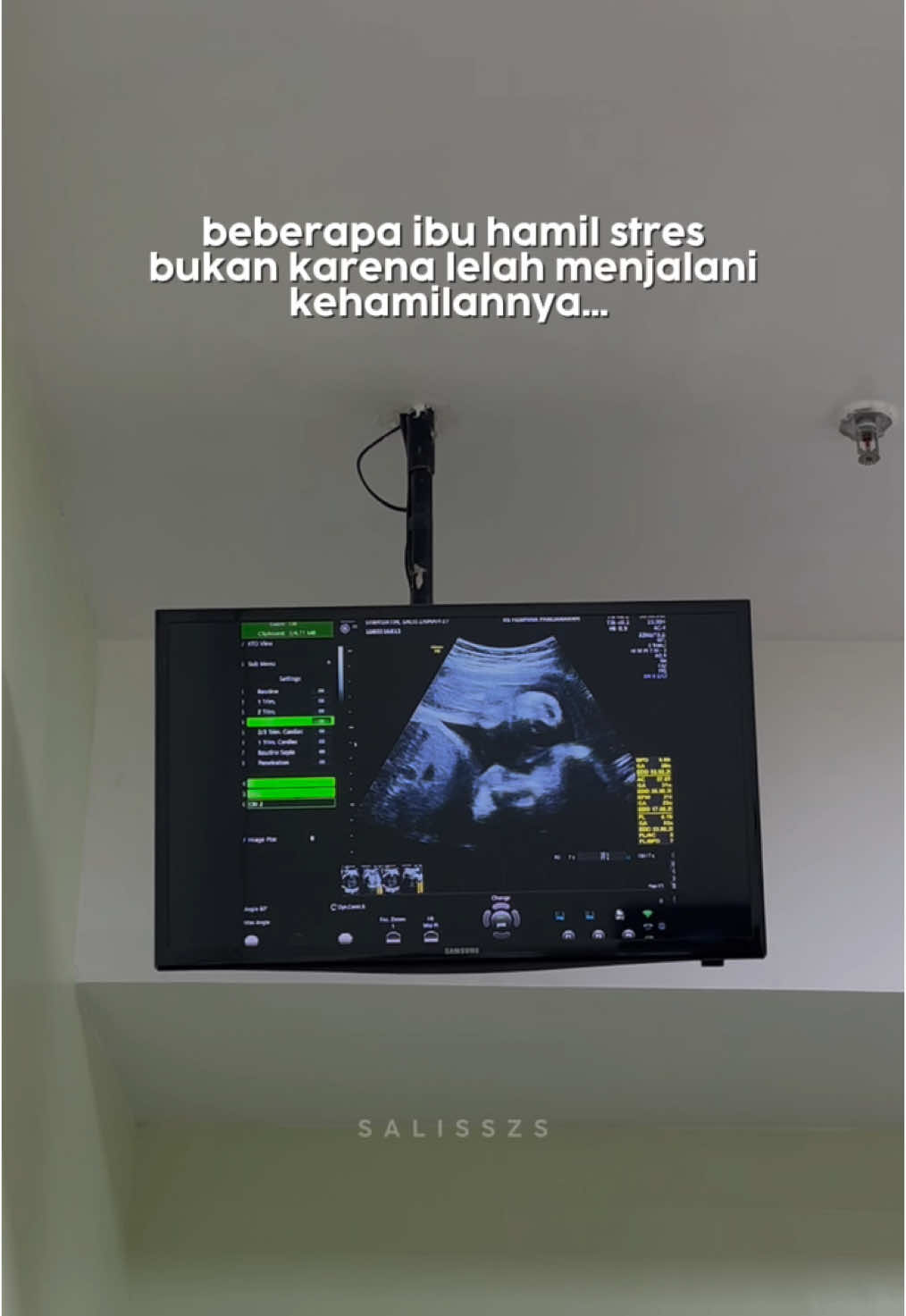 Bener ga bumil? Ada support dari orang sekitar atau tidak, semoga Allah menguatkan setiap perjuangan yang kamu hadapi. Ingat, banyak wanita yang sangat menanti berada di posisi kamu saat ini. Jadi semangat ya! 💕 #bumil #hamil #ibuhamil #ibuhebat #foryoupageofficiall #masyaallahtabarakkallah #ceritabumil #masyaallahtabarakkallah 