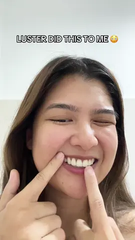 Excuse me lang Luster? ✨ Why naman ganito result ng ng Chroma Gleam teeth color corrector niyo 🫶🏻 Paalam na talaga sa yellowish at stained teeth this 2025 😄 #yellowteeth #teeth #teethcare #oralhealth #oralcare #teethcleaning 