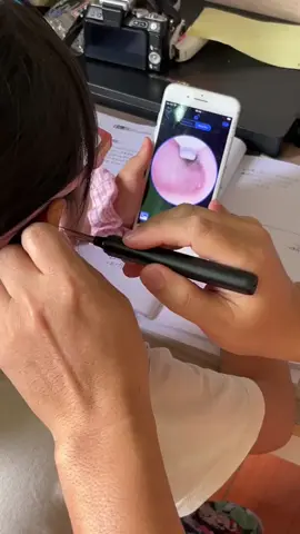 #ear #earwax #earpick #visual #earwaxremoval #softsilicone 