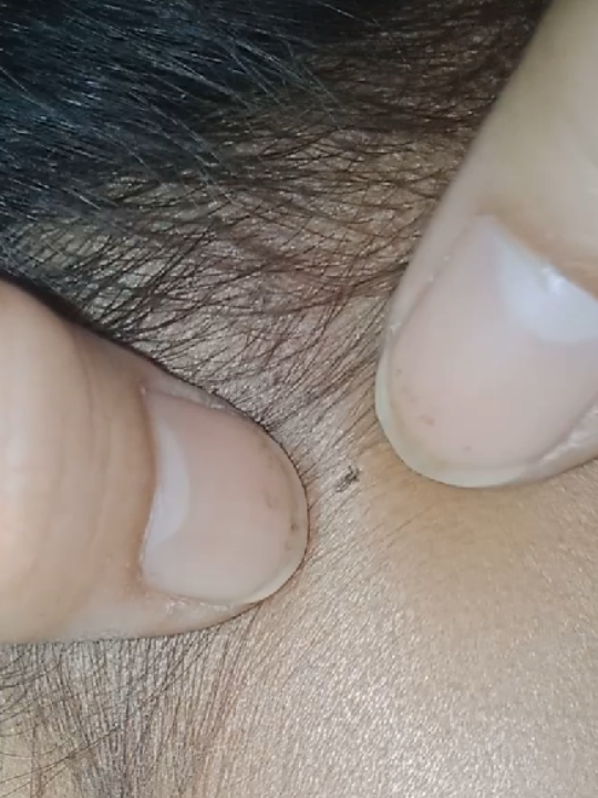 ❤️❤️❤️#lice #😭😭😭 #omg 