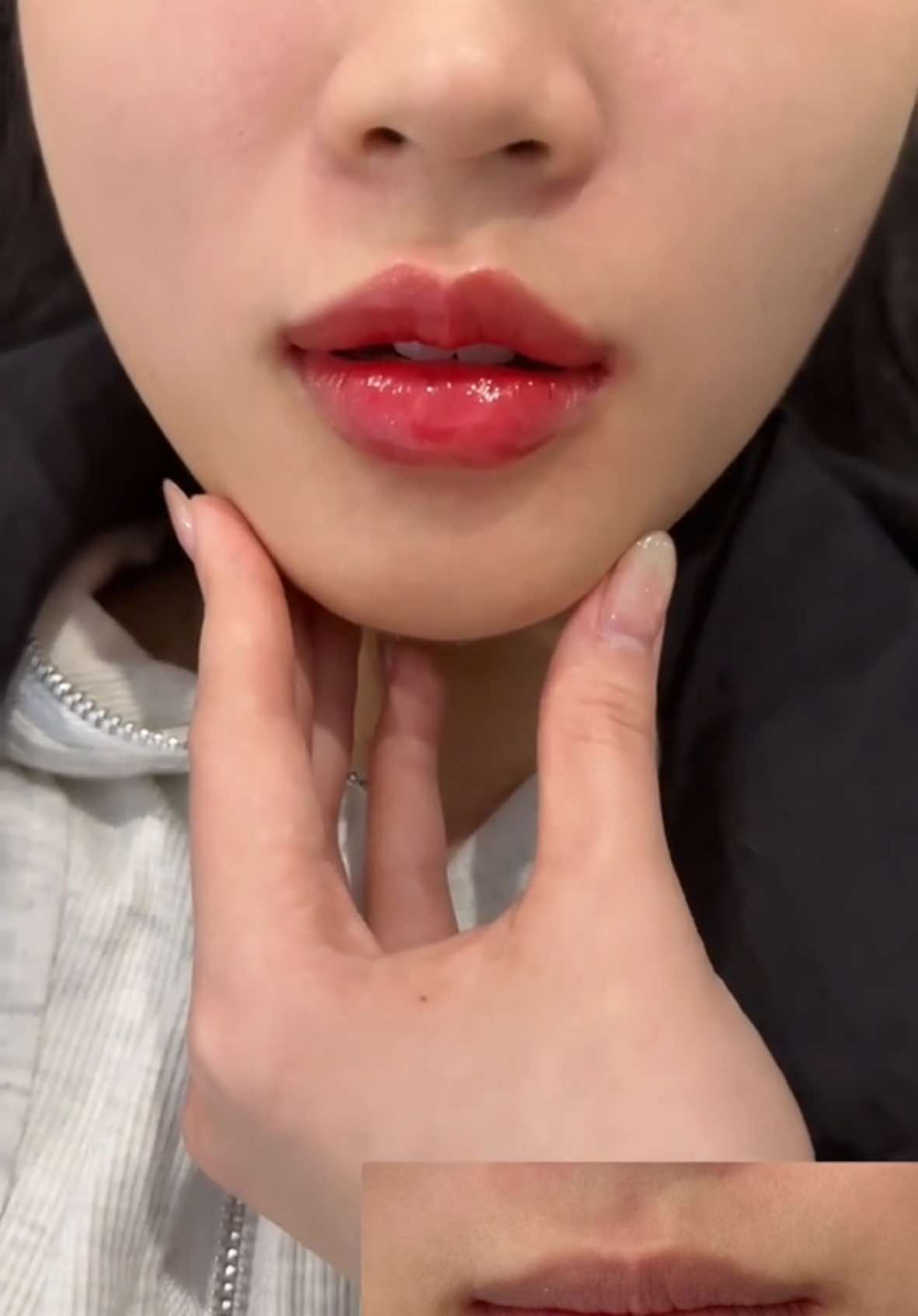 Nói không ai tin tiêm môi 1🍠