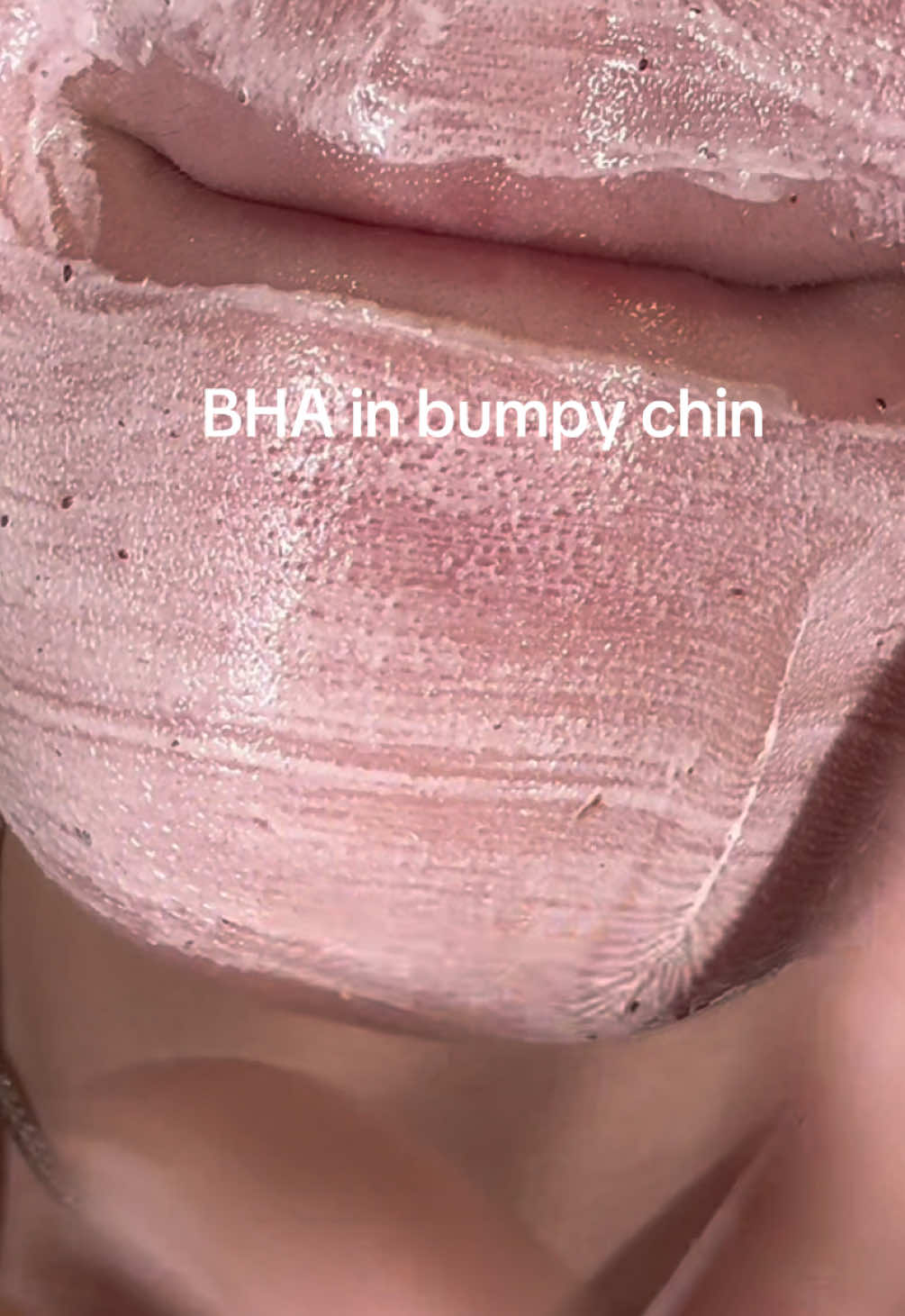 The pores vs the BHA cleanser 👀😵‍💫 #bha #anua #poredeep #cleansers #koreanbeauty #skincaretips101 #SkinCare101 #sebum #acne 