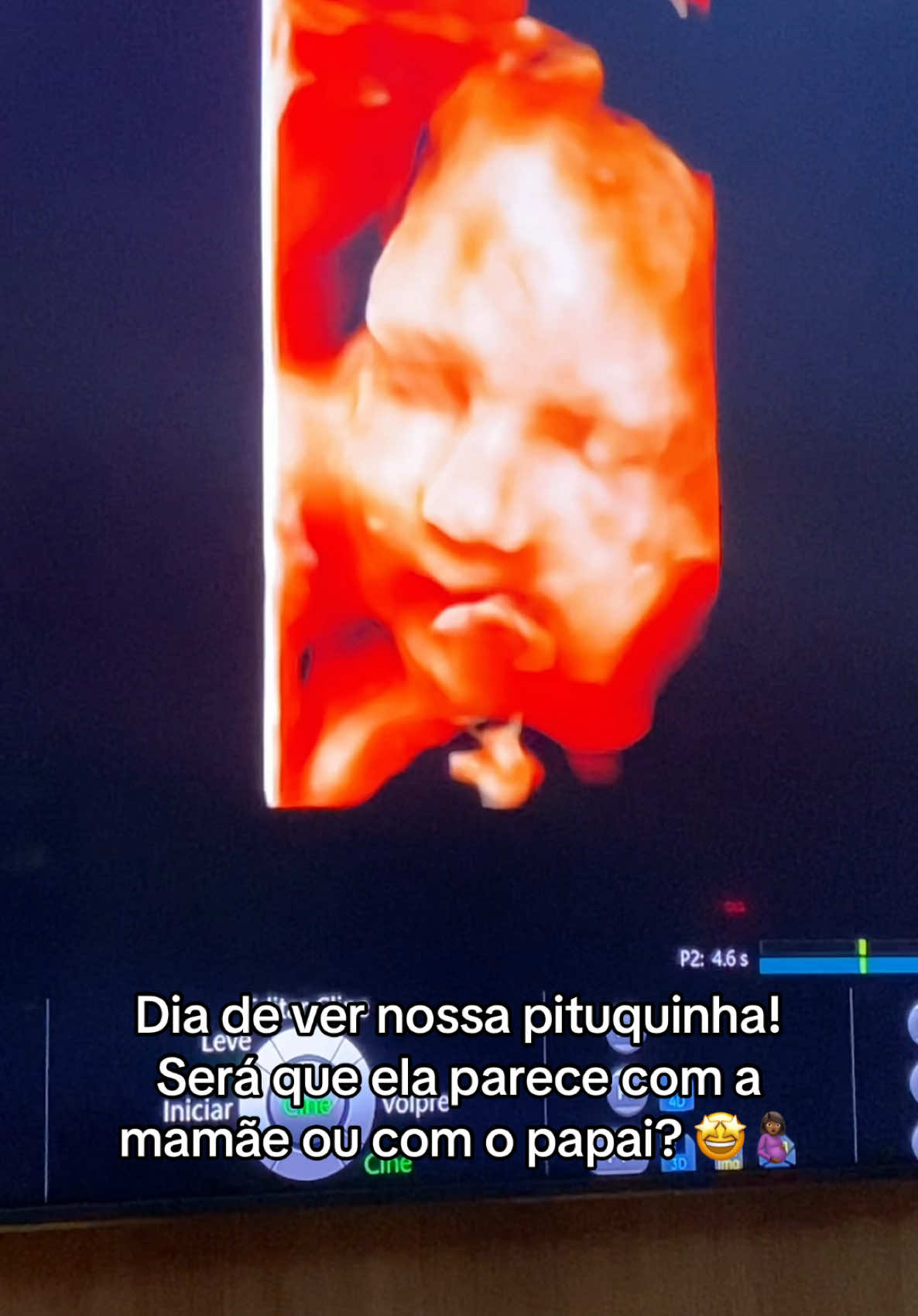 A neném parece com a mamãe ou com o papai? 🤰🏾🤩 #maedeprimeiraviagem #gravidasnotiktok #fyp #fyyyyyyyyyyyyyyyy #gestante 