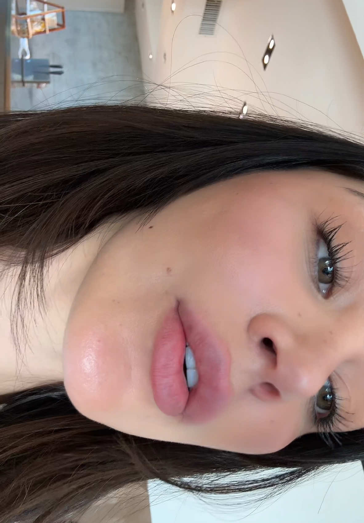 Lip Filler Vlog 💋 Disclaimer: I’m in no way promoting lip filler—I’ve just always loved a little extra pout! This is purely personal preference and what I feel looks best on me. It’s a want, not a need.  I last dissolved my lips in 2022, waited almost a year, and then refilled with 1 syringe of Restylane Kysse. A couple of months later, I made the mistake of filling again, which left me feeling way too overfilled, and I noticed some migration. After a few months, I decided to dissolve as much as possible in October 2024. We could’ve gone further, but I’m glad we didn’t.. my lips lost so much volume, and I had tons of wrinkles on my top lip. I waited three months for them to heal before refilling with 1 syringe of Restylane Kysse. Since it’s not ideal to dissolve as often as I did, this will be my last time for a while or maybe I won’t even have to. I’m so happy with the results and will update you guys in one week! @me.losangeles aesthetics  @Samira Soroudi, PA-C  #lipfiller 