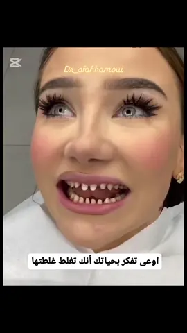 #explore #instgram #اكسبلور #اسنان #دبي #dubai #طب_اسنان #teeth #uae #انستغرام #dubai #فينير #ابتسامة #ابتسامة_هوليود #veeners #عروضات #اعلانات 