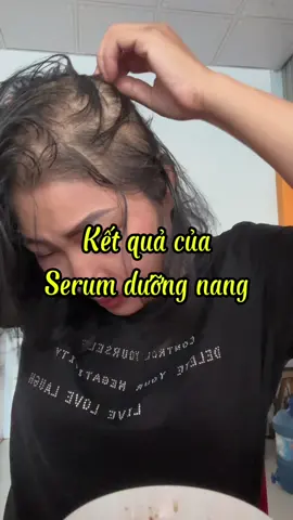 Trả lời @bảo đăng chị dùng serum bio-placenta. Kết hợp thêm ủ bồ kết, uống kẽm và cystine b6 em ạ#rungtoc #utoc 