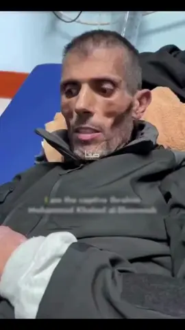 Il prigioniero rilasciato ieri 8 febbraio 2025 Ibrahim Al-Shawish parla dei metodi di tortura usati dall'esercito di occupazione sui prigionieri, ed è uno di quelli rilasciati nella Striscia di Gaza come parte dell'accordo sull'cessate il fuoco. #foryou #viral #tiktoknews #perte #cpi #humanrights #amnesty #amnestyinternational  @Berenice 5 La Vendetta @Mays4 @cotolettafit @Berenice 7 @Valentina🍉 @hollyholly2802 @Sailor Moon🌙 @andrearinaldo419 @dea20.6 @GENNYBRUNO @Giusi✌️🍉🇵🇸 @Ilaria🇵🇸❤️ @Jataa9 @Kikashinigami💫 @Melanipa 🖤 @Mimi Babba @Occhi Di Gatto🐈‍⬛ @reny15 @roberta_240215_ @_pinky 