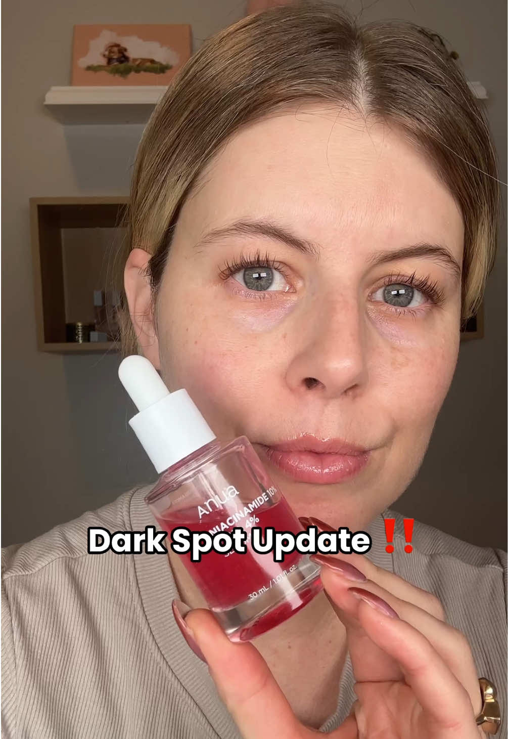 If you get dark spots too--make sure you wear sunscreen daily!! Using products like this won't help if you get sun @Anua Store US @anua_global #darkspots #kbeauty #hyperpigmentation #skincarereview #skincareroutine