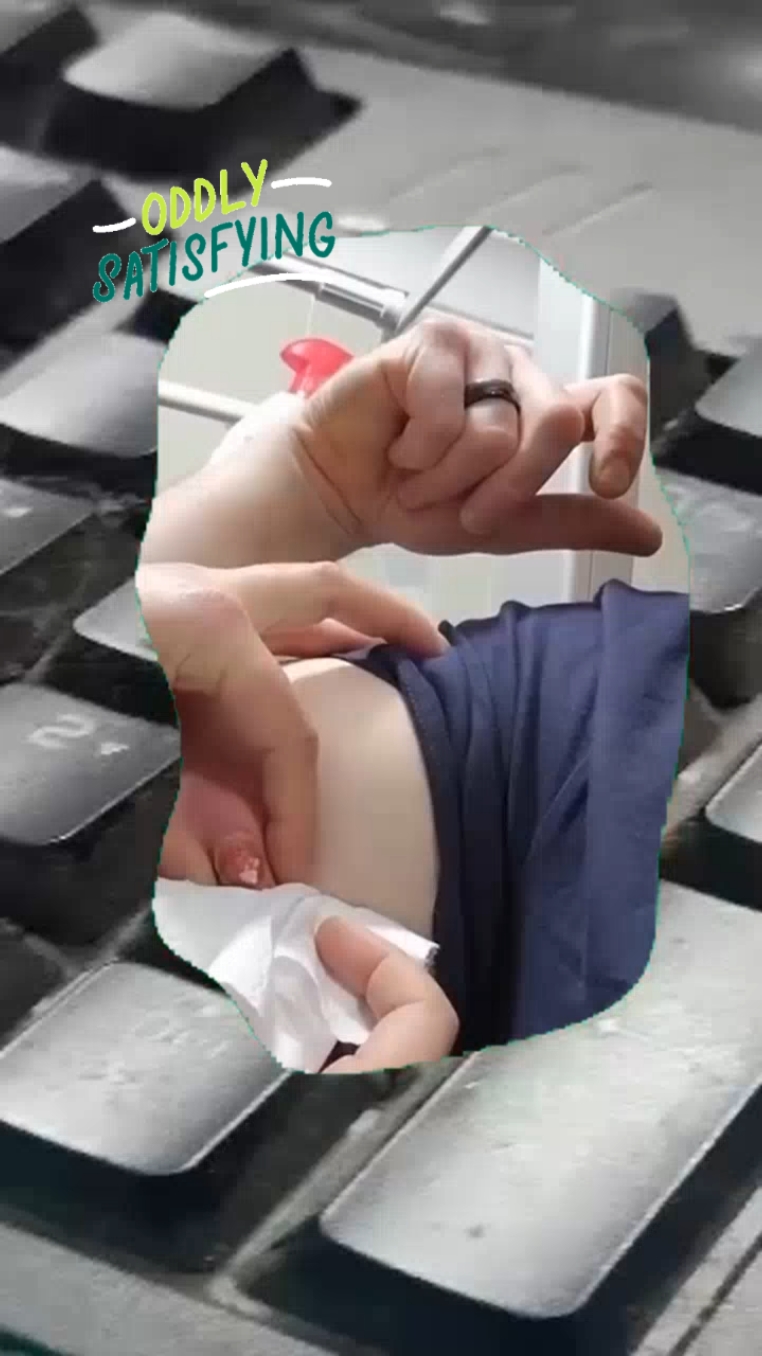 #squeeze #squeezeyuk #pimple #pimplepop #blackhead #satisfyingvideo 
