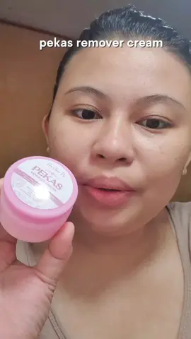 her choice pekas remover cream for melasma,pekas,freckles,darkspot remover,brightening,anti acne,anti aging #pekas  #melasma  #pekasremover  #herchoiceph 
