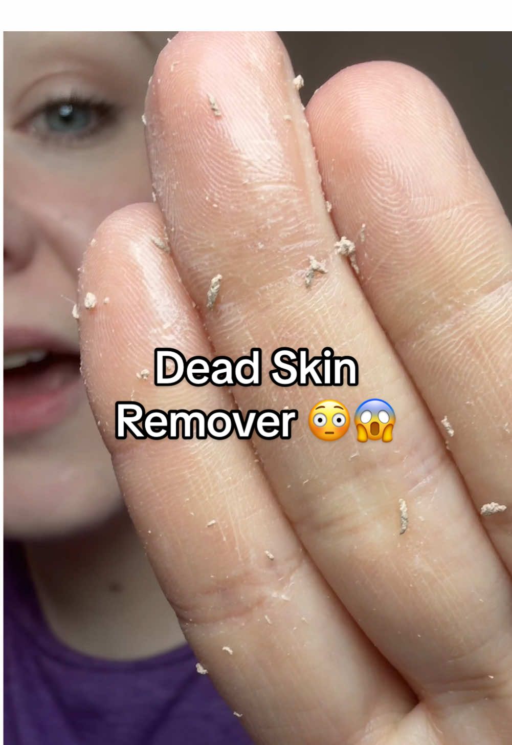 The amount of dead skin this rice exfoliatant removed is absolutely crazy! BUT it left my skin so smooth, Korean skincare wasn’t messing around with this one.  #deadskin #exfoliation #riceexfoliator #koreanskincare #glasskin #skincareroutine #blackheadremover #fypskincare 