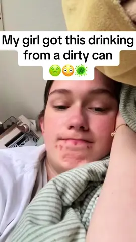 I CAN’T DRINK FROM A CAN WITHOUT THIS NOW🥴😩 #dailylife #sippycup #snappycap #soda #energydrink #fyp #lifehacks #drink  Since I got her this snappy cap she’s been feeling so much better🥹