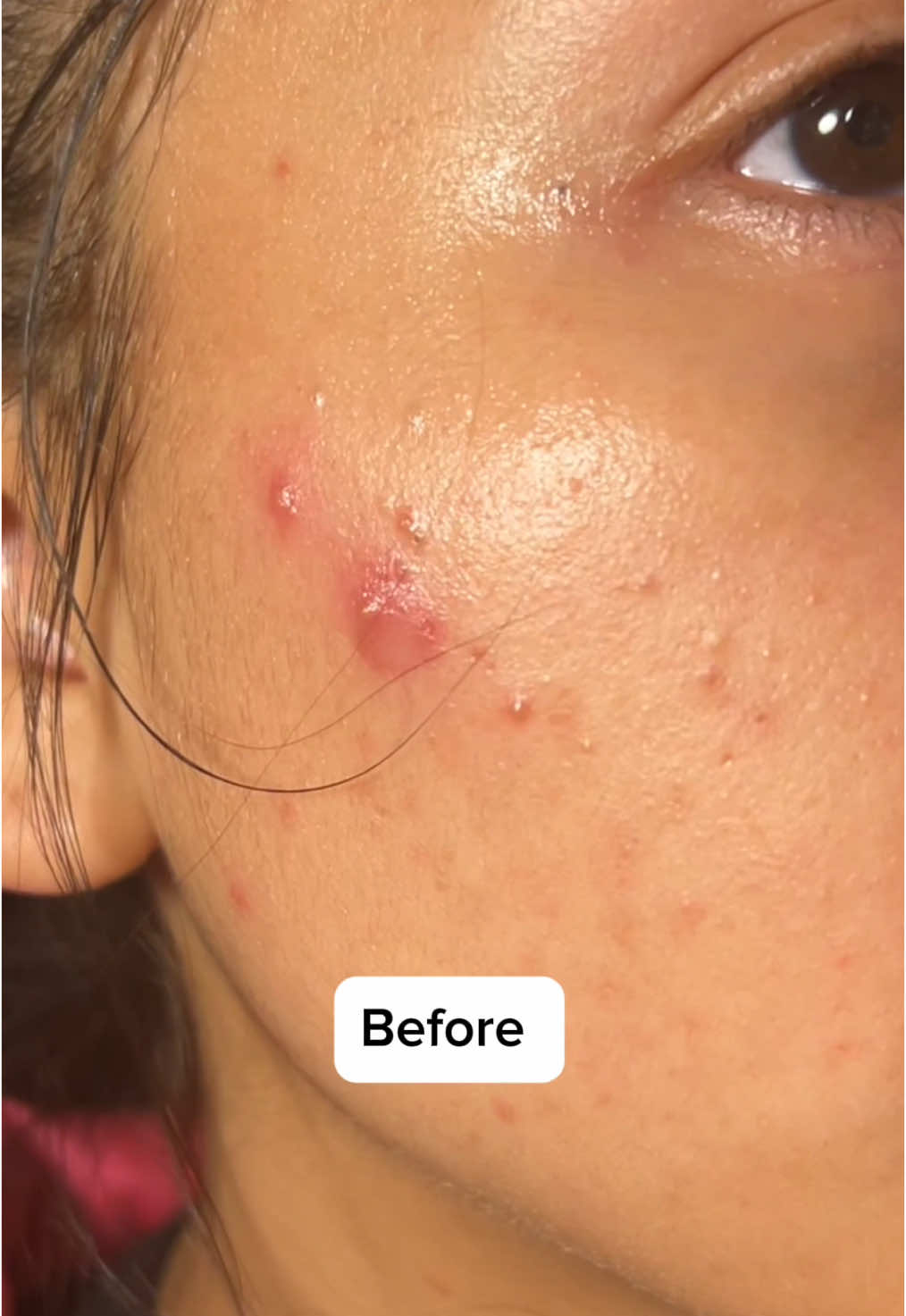 This is one of my favorite creams @centellian24_official  Madeca Cream Time Reverse ⏮️ I use this daily it really helps with acne breakouts. it has amazing fast results!! Helps with collagen production, appearance of fine lines, and repairs damaged skin❤️ if you have tried this what’s your opinion? #timereverse #madecacream #centellian24 #bestacnetreatment #fastresults #CapCut 