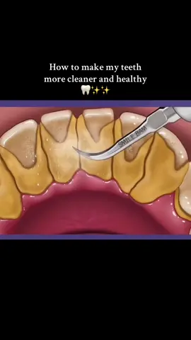 How to make my teeth more cleaner and healthy 🦷✨✨ #foryou #uk #viral #giftideas #goodthing #amazonfind #Tiktokmademebuyit #fyp #TikTokShop #spotlightfinds #trending #teethcleaning #teethcare #toothbrush #lifehacks #dental #electrictoothbrush 