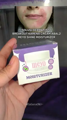 solusi breakout karena krim abal2 🥲 #musuhcreamabal2 #moisturizer #solusidermatitis #solusibreakout #meyoshine 