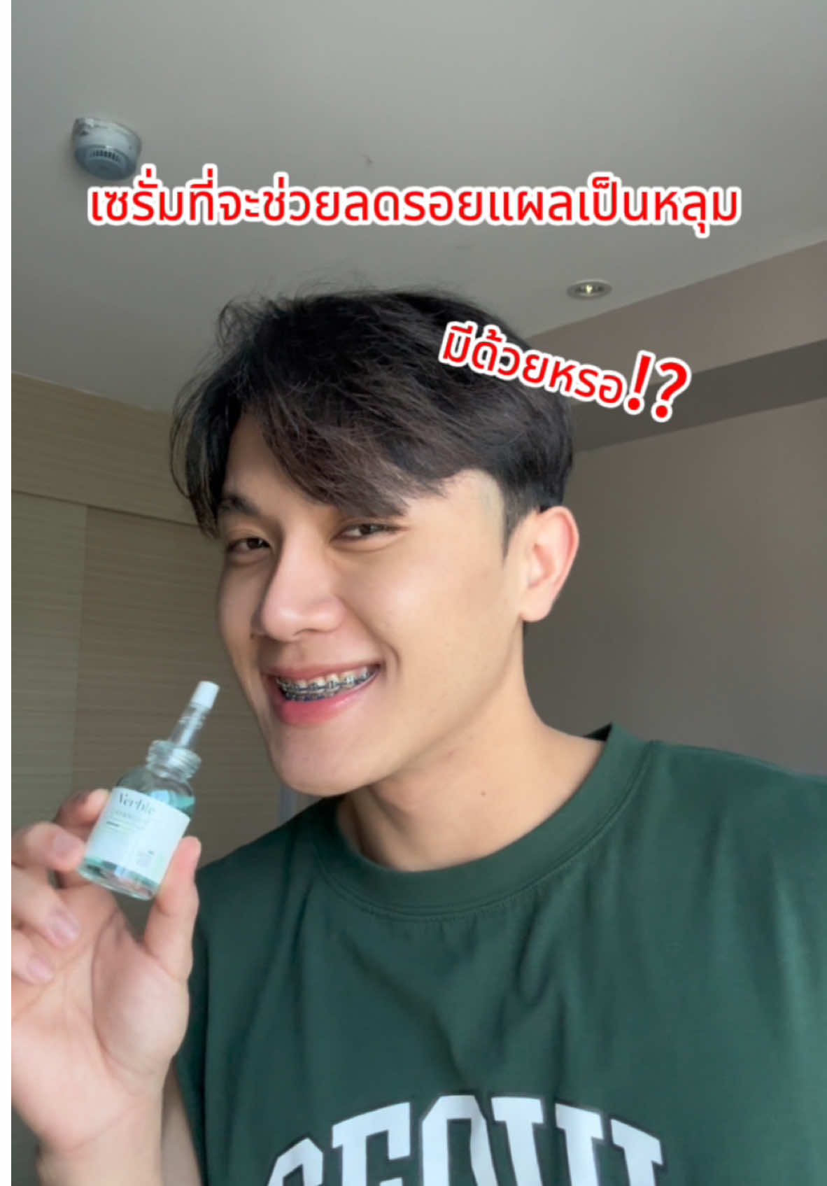 เซรั่มที่จะช่วยลดรอยแผลเป็นหลุม!! #verble #verblethailand #pittedscarsserumverble #เซรั่มรักษาแผลเป็นหลุมVerble