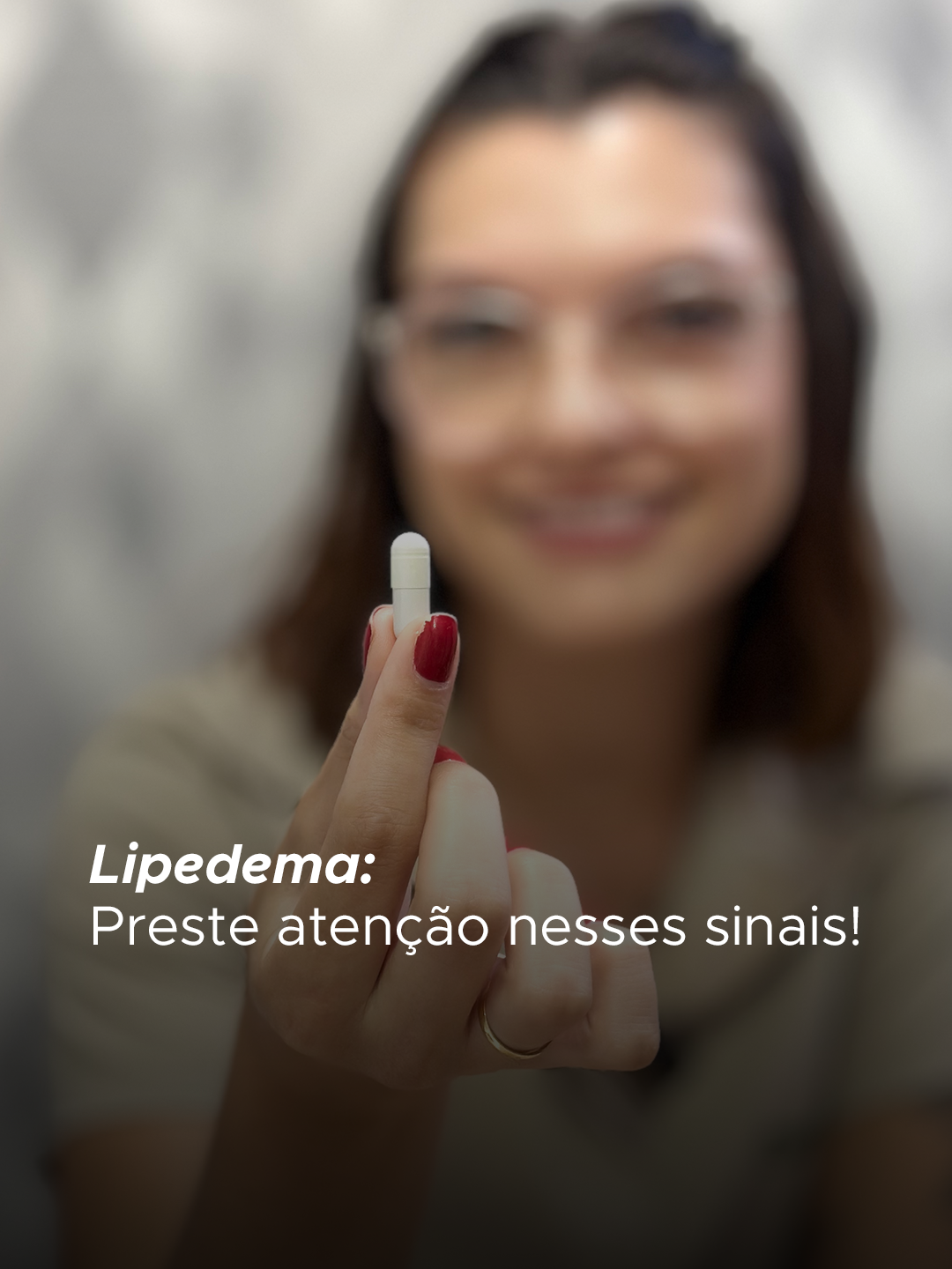 Lipedema: Presta atenção nesses sinais 👇 Se ao apertar a pele das pernas você percebe buraquinhos ou gruminhos irregulares, essa pode ser uma característica do lipedema. Além disso, cerca de 50% das mulheres com a condição conseguem fazer hiperextensão, como encostar o dedão no antebraço. Outro sinal comum é o acúmulo de gordura na região do tornozelo, sem afetar os pés. Comente 