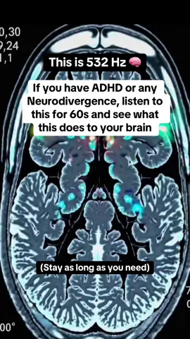 Did it clear your mind and stop the overthinking? 🤔 THE ADHD PLAYBOOK 📖 has 134 life-changing strategies that have helped me not just cope but thrive with ADHD! 🙌 Details in my bi0 ❤️ #adhd #neurodivergent #adhdtiktok 
