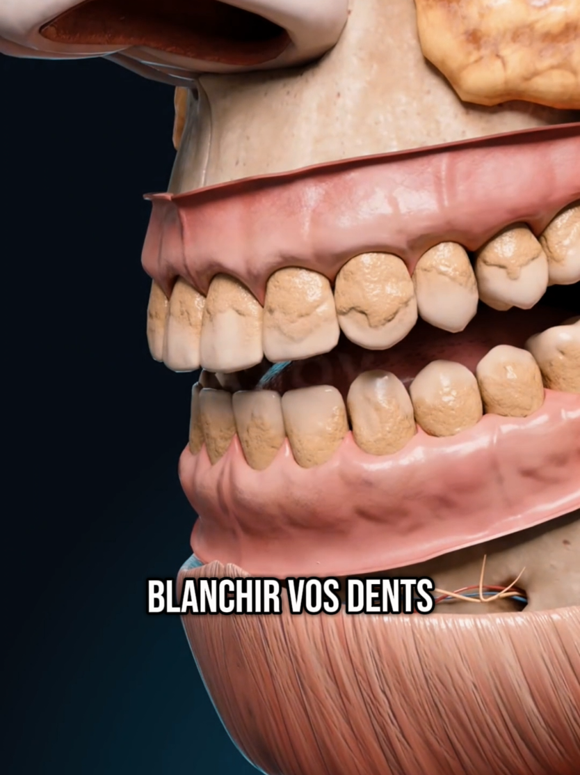 Blanchiment des dents immédiatement éliminer les tartre en 1 nuit . #dents #blanchimentdentaire #facettedentaire #remedenaturel 