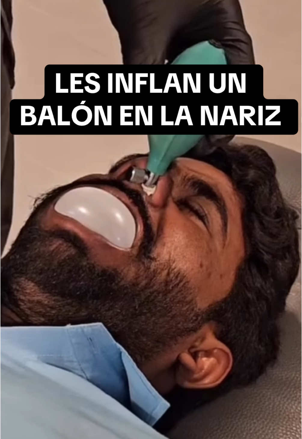 Les INFLAN un BALÓN dentro de la NARIZ - Craniofacial release - ¿FUNCIONAN estas prácticas? —— They INFLATE a BALLOON inside their NOSE - Craniofacial release - DO these practices WORK? #dentalk #dentista #ent #dentist #otorrino #nariz #nose #cfr #quiropraxia #chiropractic #odontologo #drpardinaslopez