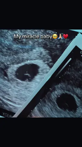 GODS MIRACLE🙏🏼🥹. THANK YOU LORD! DUE SEPT 2025♥️ #god #godisgreat #blessed #blessedmama #pregnant #pregancy #pregancytiktok #prego #pregnantmama #babyontheway #babyonboard #ultrasound #ultrasoundscan #godsmiracle #havefaithingod #faith #hellobaby #fyp #fypシ #fypシ゚viral 