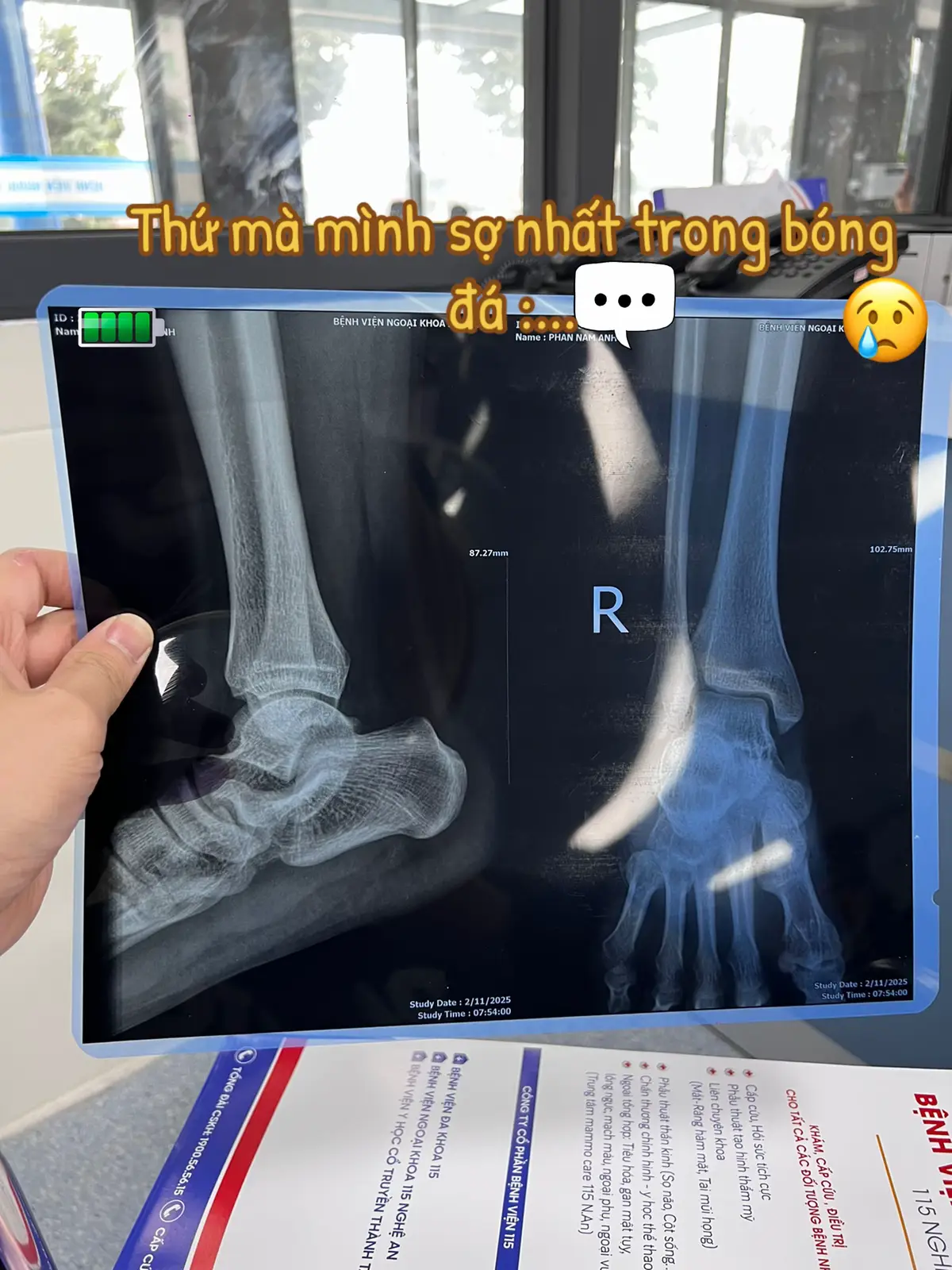 #xh #xhtiktok #chanthuongthethao #latcochan 