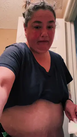Shot day!!! I gained like 6oz 😂 I’m ok with that. Decided to inject to the right of my belly button today ❤️ Hopefully we can reach 195 this week #weightloss #onederland #health #glp1 #Mounjaro #