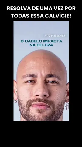 Quer resolver essa Calvície de uma vez por todas e deixar se ser Careca?  O site do tratamento está na biografia do meu perfil! #minoxidil #finasterida  #calviciemasculina #calvicie #quedadecabelo #saudemasculina #cabelo  #careca 