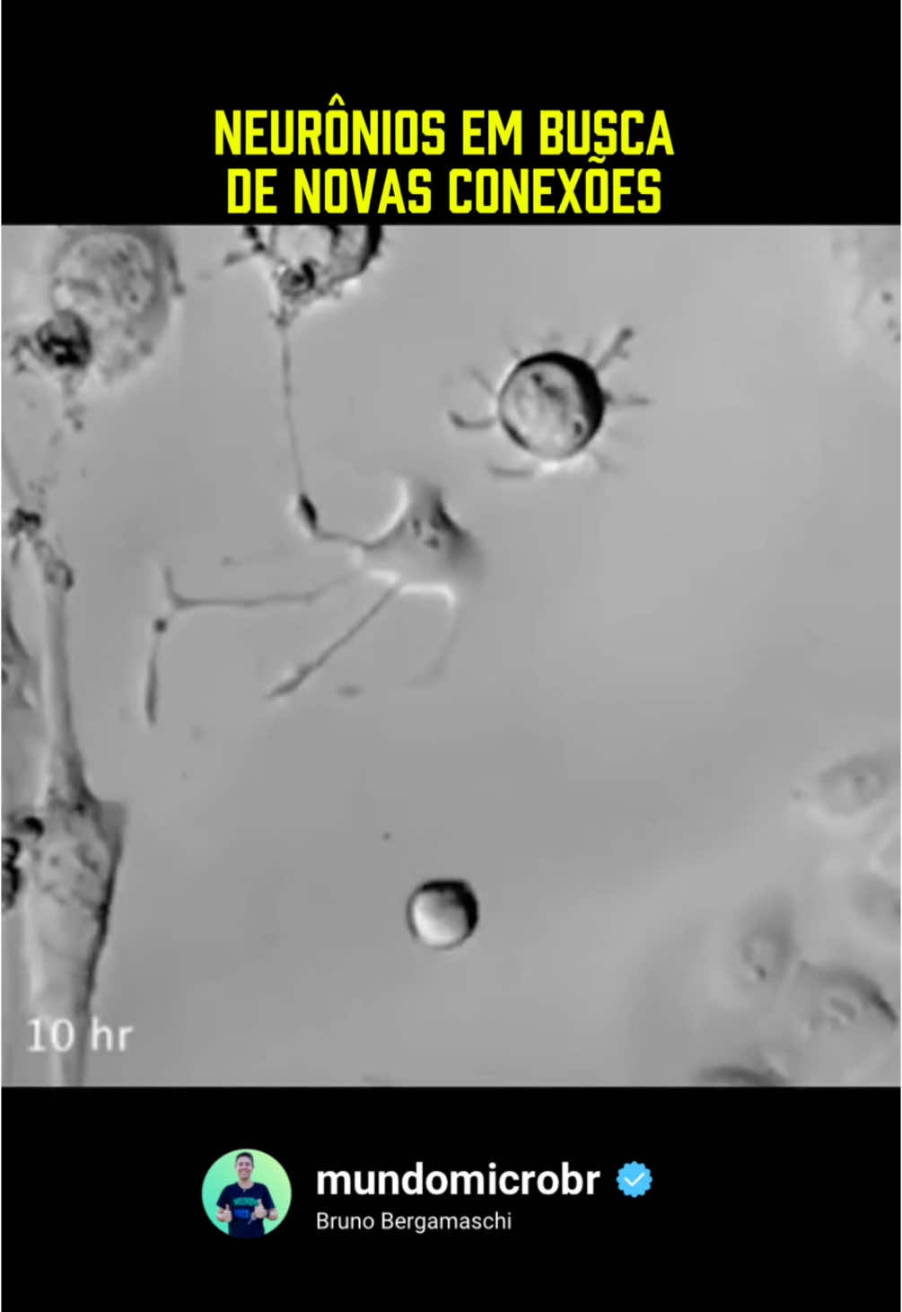 Neurônios em busca de novas conexões 🧠 #microscopio #microbiologia #neuronios #biologia #anatomia 
