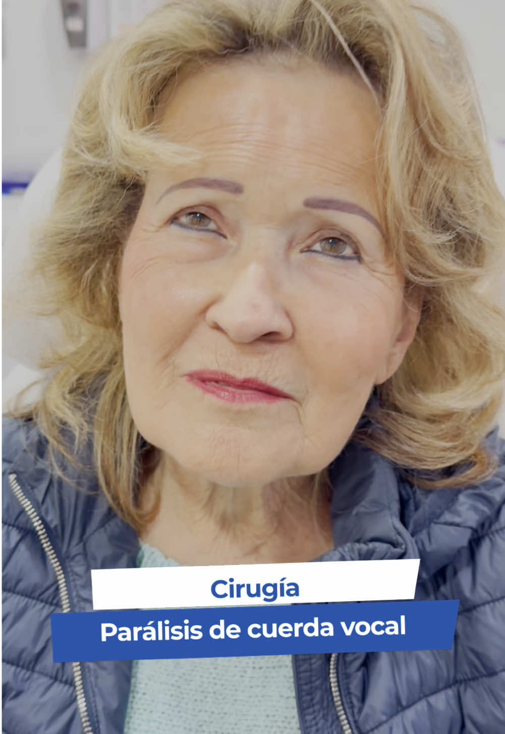 La parálisis de cuerdas vocales, que ocurre cuando un nervio motor que controla las cuerdas vocales se ve afectado, puede alterar gravemente la voz.  Sin embargo, con el tratamiento adecuado, como el que ofrece el Dr. Avellaneda, es posible restaurar la función vocal. Con cirugía y rehabilitación, tu voz puede volver más fuerte y clara que nunca. ¡Todo es posible! 🎤✨  #CentroEleva #Recuperación #RecuperarMiVoz #ParálisisVocal #fypcolombia 