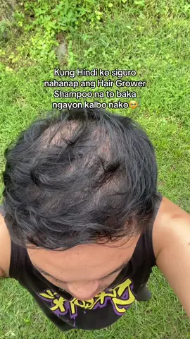 At Dahil sa shampoo nato bumalik ang kumpyansya sa sarili ko #hairgrowershampoo #shampoo #minoxidilshampoo #hairgrower #biotin #minoxidil #minoxidilresult #shampooformen #bestshampoo #besthair #besthairgrowthproduct #kormesicgingershampoo #koreanshampoo #fyp #fypシ゚viral #fypage #fyppppppppppppppppppppppp 