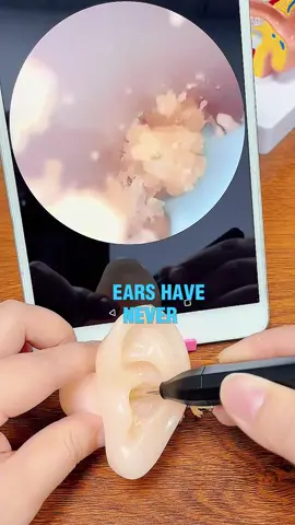 #relax #asmr #ear #earwax #earwaxremoval #earwaxchallenge #satisfyingvideos #SelfCare #earcleanerwithcamera #tiktokshop #fyp #foryoupage #tiktokmademebuyit #acne #earwaxcleaning #earcleaningvideos #satisfy 