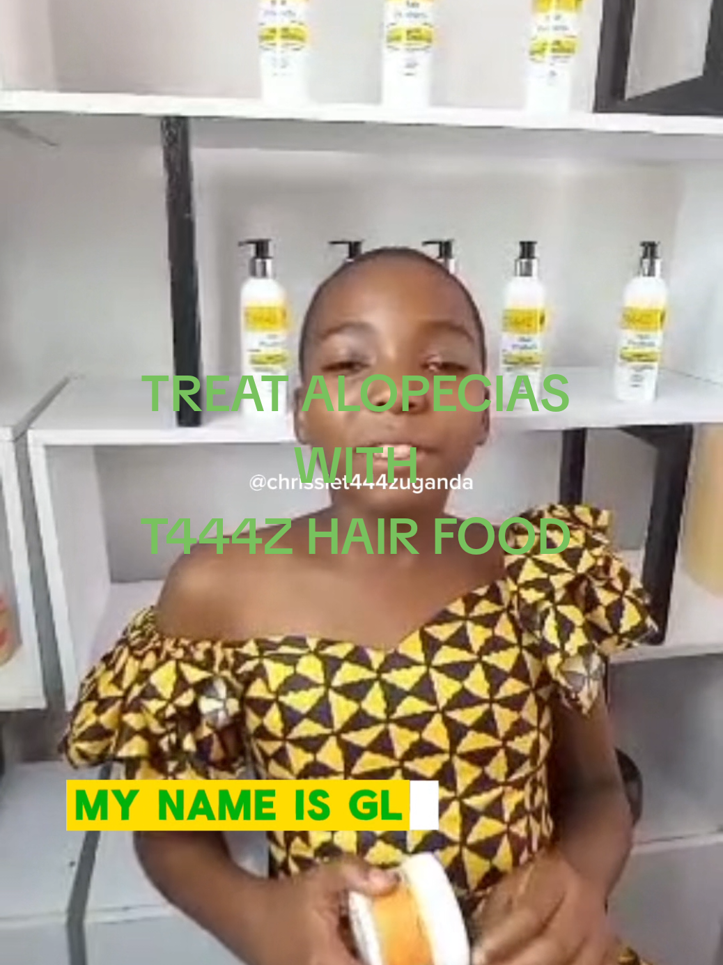 SAY GOODBYE TO ALOPECIAS,  USE T444Z HAIR FOOD@T444Z HAIR NURTURING.  Treat balding and scalp hair loss like alopecia using T444Z hair food@T444Zhairproducts. #fyp #alopeciaawareness  #alopecialife #alopeciatreatment  #scalpcare #causesofalopecia  @creative.learning39 #alopeciatreatmentforblackwomen  #childrenandalopecia  #copingwithalopecia  #trendinghairproducts 