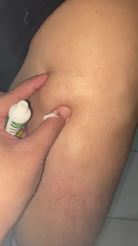 Cream ini bisa bantu mengempeskan benjolan tapi harus sabar bangett yah gak bisa instan, dan tidak disarankan dipake ibu hamil #creambenjolan #creamlipoma #pengempesbenjolan #benjolankempes #fypシ゚ 