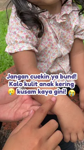 Jangan cuekin ya bund, coba rawat pakai soothing baby crème biar kulit si kecil lebih sehat lembab dan glowing!😍🤗 Langsung klik keranjang kuning! #purela #skincareanak #rekomendasiskincareanak #skincareanakaktif #brandofthemonth 