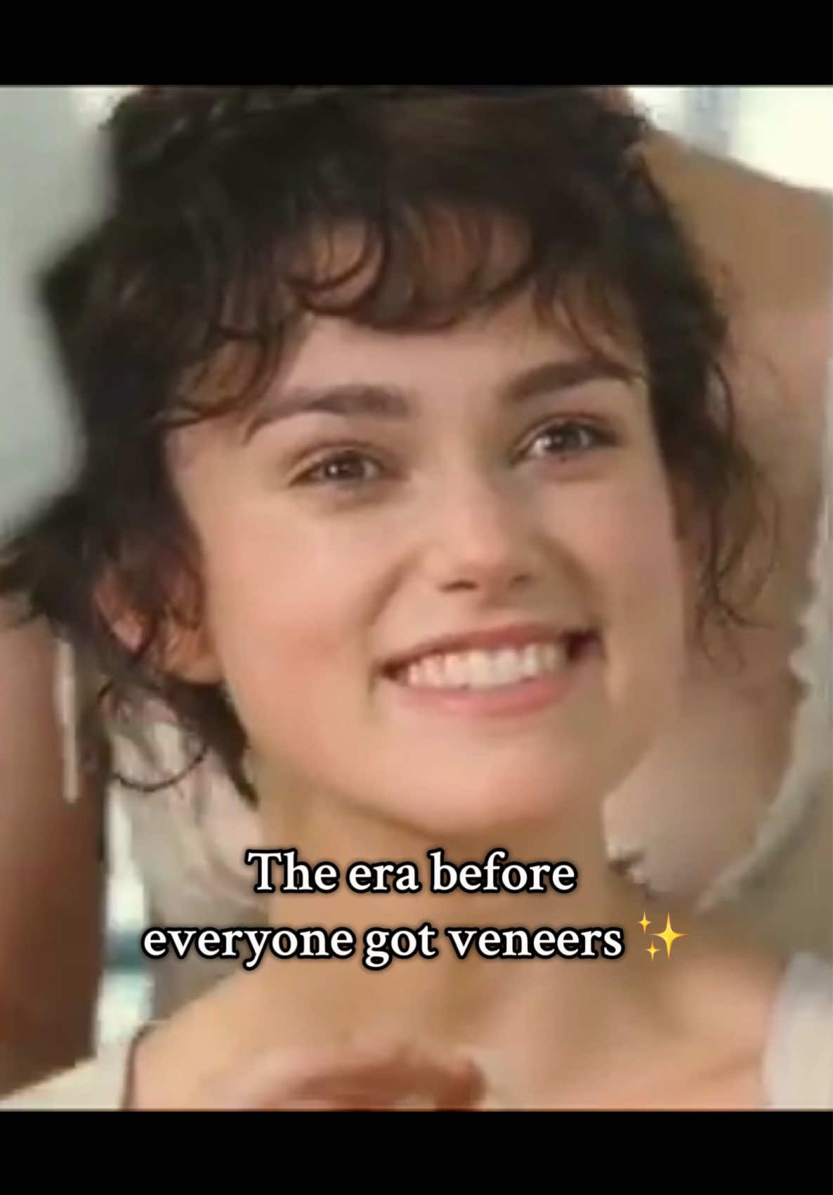 I loved it when no one’s teeth looked like dentures! Teeth adds so much character #beautytrends #veneers #beauty 