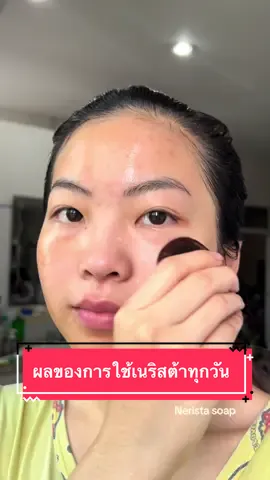 ผลของการใช้สบู่เนริสต้าทุกวัน #สบู่เนริสต้า #เนริสต้า #เจ้าของแบรนด์เนริสต้า #nerista #tiktok #fyp #ฟีด #อย่าปิดการมองเห็น #หน้าใส #ของดีบอกต่อ #ลดสิว #fypシ #สิวหาย 