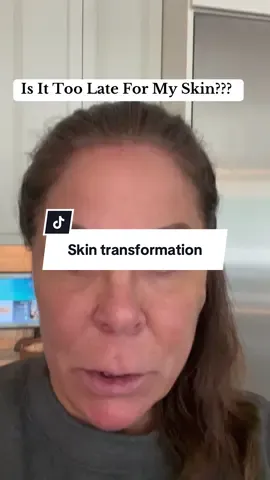 LET’S GO OVER 50 LADIES ❤️ SKIN TRANSFORMATION YEAR #skintransformation #transformation #skincare #antiaging #antiagingskincare #over50skin #matureskin #matureskincare #over50skincare 