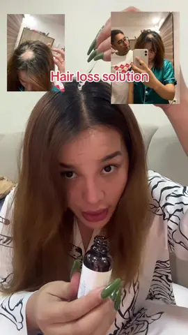 No more poknat super effective din ang brand nato! #minoxidil #haircare #hairloss #hosoku #fyp #hair #foryou 