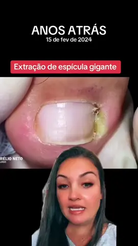 #anosatrás #unhas #limpezasatisfatoria #reagindo 