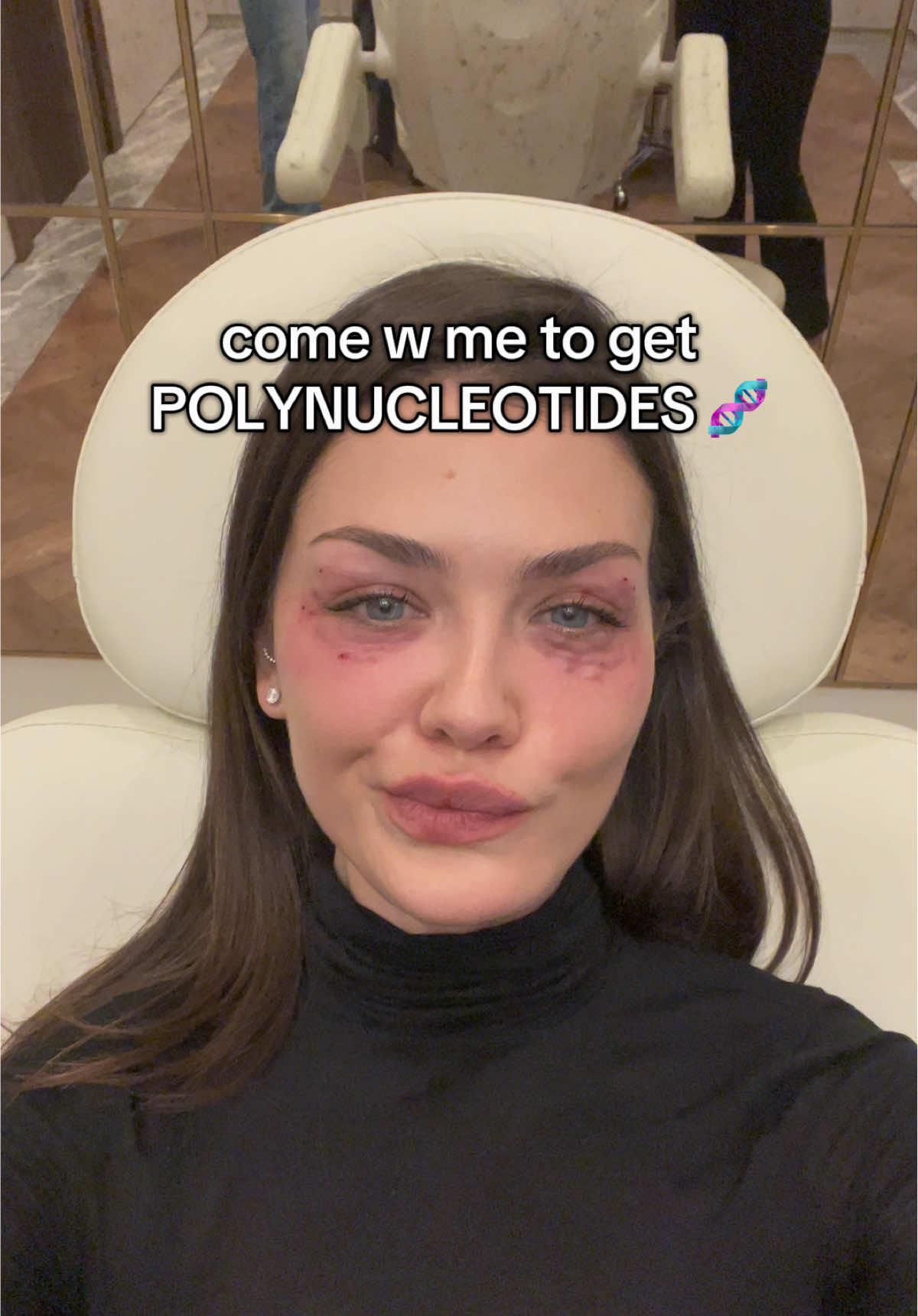 Polynucleotides w @Dr Rasha Clinic 