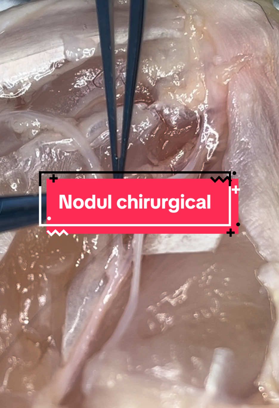 Nodul chirurgical, la microscop  #microscop  #microsurgery  #microchirurgie  #medicina  #rezident  #filmat 