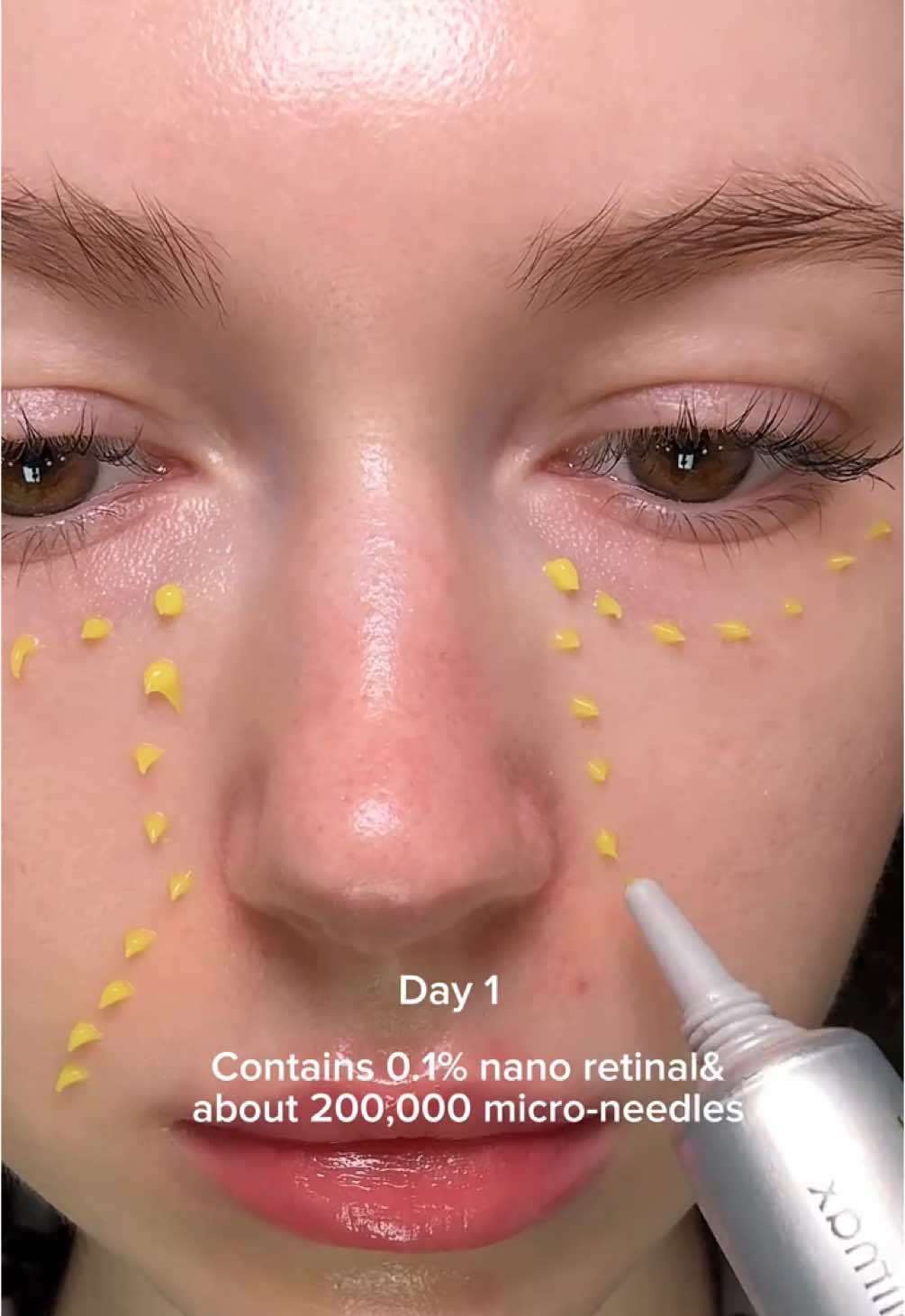 The power of retinal ✨ #retinal #celimax #retinol #koreanskincare #pores #kbeauty  
