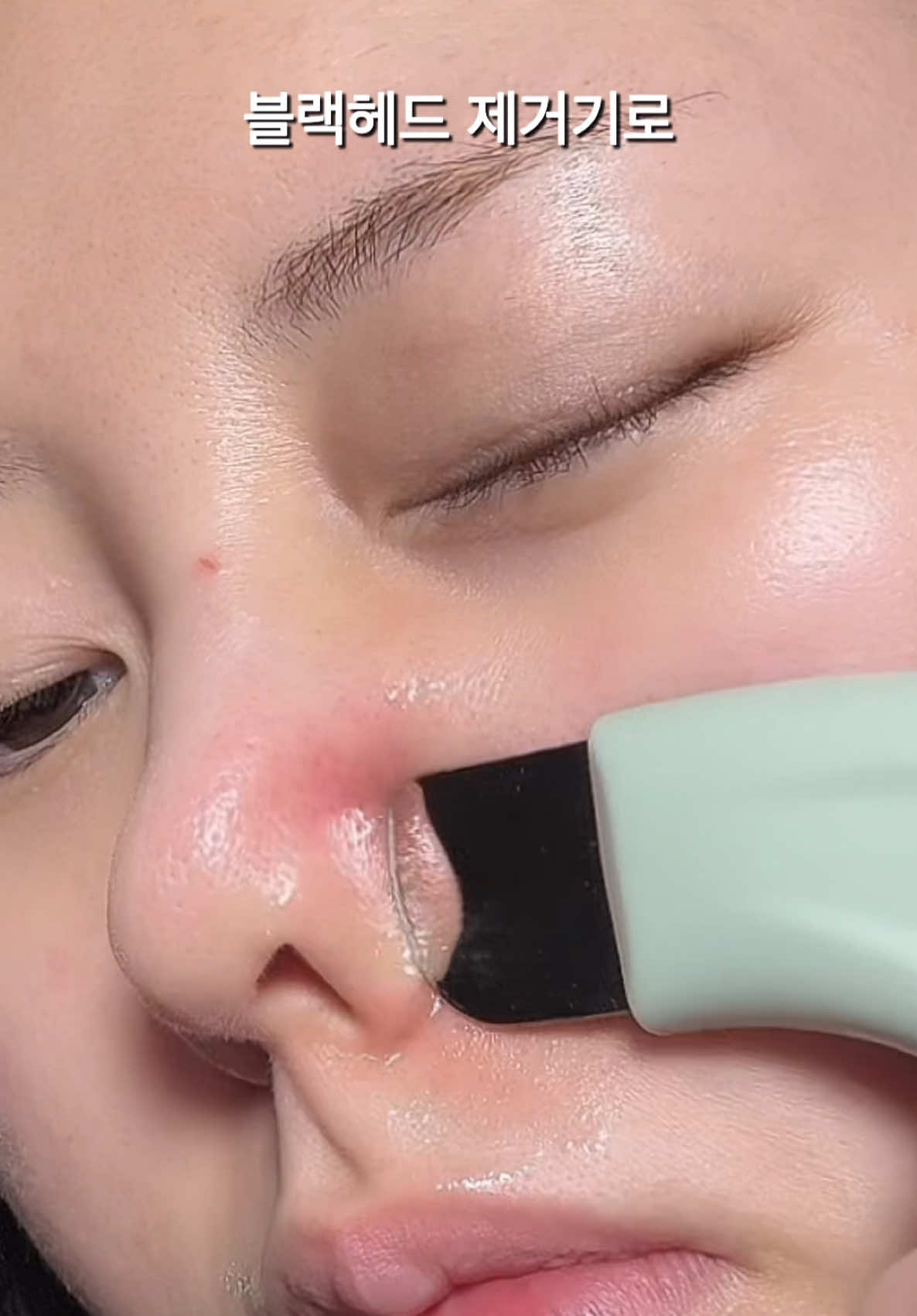 주에 한번씩은 꼭 #일소코팩 해주는데 #올영 에 패드형태로 되어있어서 한번 사봤습니당ㅋㅋ#성분에디터 제품이고 #홍현희코팩 르로도 불리는 #블랙헤드멜팅클리어코팩  붙이고 한 5-10분뒤에 떼어내서  내장 압축면봉이나 블랙헤드제거기로 살살 밀아내주먄 끝! 일소 대체용으로도 괜찮네요 불려지는게 강력한건 일손데 얘는 마일드하게 불려지고 좀더 경제적이어서 이것도 꽤 잘 쓸듯 해욮 #올영 #올리브영 #코피지 #피지제거 #코피지제거 #코피지관리 #블랙헤드 #피지제거 #피지제거기 @sungbooneditor_official_us_pr 