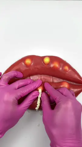 Practice injecting pimples on the lips and removing some of them. Satisfying?#lips #siliconemodel #capcut #howtomakepimples #acnetreatment #asmrtiktoks #asmr #fypシ #viralvideo #pimple #pimplepopping #pimple_popper_asmr #asmrtingles #asmrtriggers #tingles #artificialskin #education #oddlysatisfying #relaxingcontent #skincaretips #asmrsounds #mochipimplepopping #bonniepimplepopperasmr 