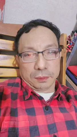 နဖူးကျဥ်းသူနဲ့ နှာခေါင်းပုတိုအကြောင်း